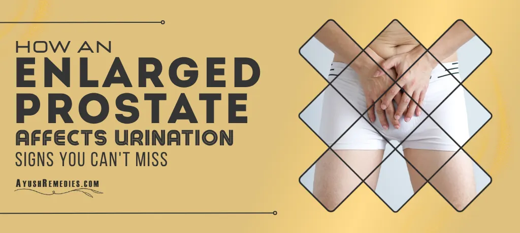 How an Enlarged Prostate Affects Urination, Prostate Enlargement and Urine Issues